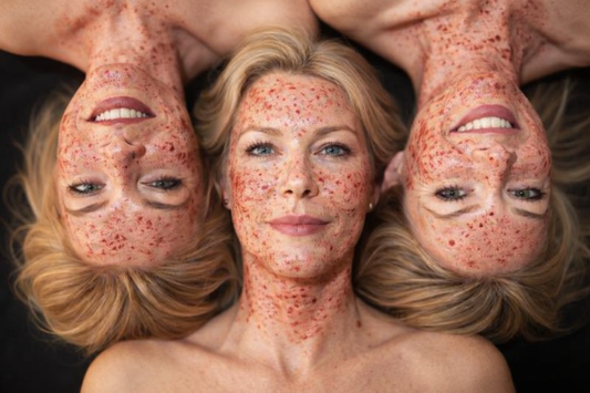 What Is PRP? A Naturopathic Doctor Explains Platelet Rich Plasma for Skin, Hair & Joints